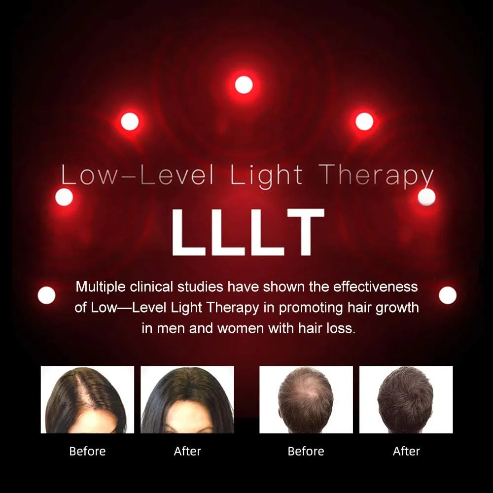 LESCOLTON Hair Growth Helmet Laser Cap Infrared Light LED Helmet Hair Growth Hat Hair Loss Device